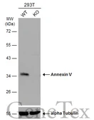 Anti-Annexin V antibody used in Western Blot (WB). GTX103250