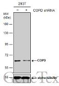 Anti-COPD antibody used in Western Blot (WB). GTX103252