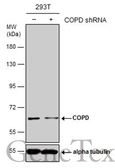 Anti-COPD antibody used in Western Blot (WB). GTX103252