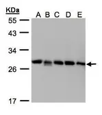 Anti-Rho GDI2 antibody [N1C3] used in Western Blot (WB). GTX103254