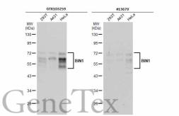 Anti-BIN1 antibody used in Western Blot (WB). GTX103259