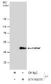 Anti-Homer1 antibody used in Immunoprecipitation (IP). GTX103278