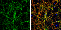 Anti-Homer1 antibody used in Immunocytochemistry/ Immunofluorescence (ICC/IF). GTX103278