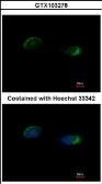 Anti-Homer1 antibody used in Immunocytochemistry/ Immunofluorescence (ICC/IF). GTX103278