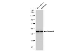 Anti-Homer1 antibody used in Western Blot (WB). GTX103278