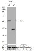 Anti-KLF5 antibody used in Western Blot (WB). GTX103289