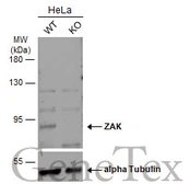 Anti-ZAK antibody [N3C2], Internal used in Western Blot (WB). GTX103317