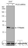 Anti-T-Plastin antibody used in Western Blot (WB). GTX103323