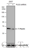 Anti-T-Plastin antibody used in Western Blot (WB). GTX103323