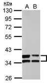 Anti-Annexin III antibody used in Western Blot (WB). GTX103330