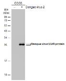 Anti-Dengue virus NS4B protein antibody used in Western Blot (WB). GTX103349