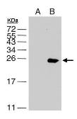 Anti-Dengue virus NS4B protein antibody used in Western Blot (WB). GTX103349
