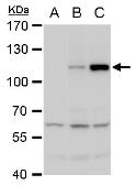Anti-Dengue virus NS5 protein antibody used in Western Blot (WB). GTX103350