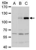 Anti-Dengue virus NS5 protein antibody used in Western Blot (WB). GTX103350