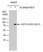 Anti-Hepatitis C virus NS3 protein antibody used in Western Blot (WB). GTX103356