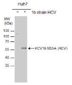 Anti-Hepatitis C virus NS5A protein antibody used in Western Blot (WB). GTX103358