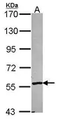Anti-Cytochrome P450 2A6 antibody [C1C2], Internal used in Western Blot (WB). GTX103360