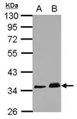 Anti-PPM1J antibody used in Western Blot (WB). GTX103370
