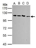 Anti-SART1 antibody [N2C1], Internal used in Western Blot (WB). GTX103371