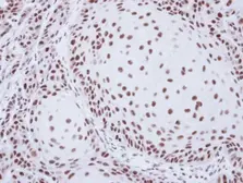 Anti-SART1 antibody [N2C1], Internal used in IHC (Paraffin sections) (IHC-P). GTX103371