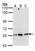Anti-DARS antibody [N1C1] used in Western Blot (WB). GTX103374