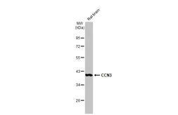 Anti-CCN3 antibody used in Western Blot (WB). GTX103377
