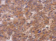 Anti-SNX9 antibody used in IHC (Paraffin sections) (IHC-P). GTX103383