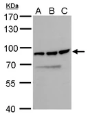 Anti-DDX18 antibody used in Western Blot (WB). GTX103392