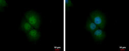 Anti-PRMT2 antibody used in Immunocytochemistry/ Immunofluorescence (ICC/IF). GTX103398