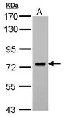 Anti-SAMHD1 antibody used in Western Blot (WB). GTX103400