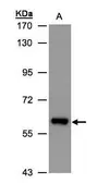 Anti-ALDH6A1 antibody used in Western Blot (WB). GTX103405