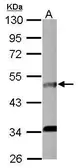 Anti-IL5 Receptor alpha antibody [N1C2] used in Western Blot (WB). GTX103418