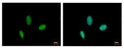Anti-RAD23B antibody used in Immunocytochemistry/ Immunofluorescence (ICC/IF). GTX103424