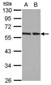 Anti-RAD23B antibody used in Western Blot (WB). GTX103424