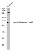 Anti-Activin Receptor Type IC antibody used in Western Blot (WB). GTX103442