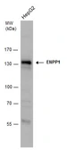 Anti-ENPP1 antibody [N2C2], Internal used in Western Blot (WB). GTX103447