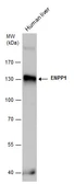 Anti-ENPP1 antibody [N2C2], Internal used in Western Blot (WB). GTX103447