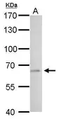 Anti-tPA antibody used in Western Blot (WB). GTX103453