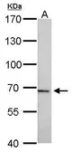 Anti-tPA antibody used in Western Blot (WB). GTX103453