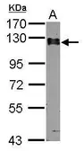 Anti-Calpastatin antibody used in Western Blot (WB). GTX103454