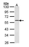Anti-GABPB1 antibody [N1C3] used in Western Blot (WB). GTX103464