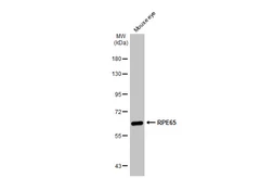 Anti-RPE65 antibody [N1C3] used in Western Blot (WB). GTX103472