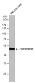 Anti-Vitronectin antibody used in Western Blot (WB). GTX103475