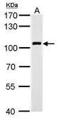 Anti-VAV1 antibody used in Western Blot (WB). GTX103489