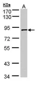 Anti-SCYL3 antibody [N1C3] used in Western Blot (WB). GTX103501