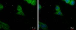 Anti-PDE8A antibody used in Immunocytochemistry/ Immunofluorescence (ICC/IF). GTX103504