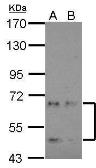 Anti-NKIAMRE antibody [N1C1] used in Western Blot (WB). GTX103512