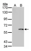 Anti-Folylpolyglutamate synthase antibody [N3C2], Internal used in Western Blot (WB). GTX103516