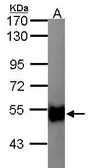 Anti-Glycerol kinase 2 antibody [N1C1] used in Western Blot (WB). GTX103519