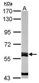 Anti-FMO3 antibody [N2C2], Internal used in Western Blot (WB). GTX103521